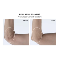 Crepe Control Tightening Body Cream 11 Crepe Control Tightening Body Cream -Cheap Beaunisa Store 2561150cm alt02