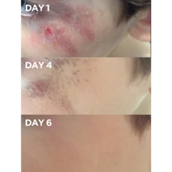 Golden Dry Skin Salve 9 Golden Dry Skin Salve -Cheap Beaunisa Store 2567518cm alt03