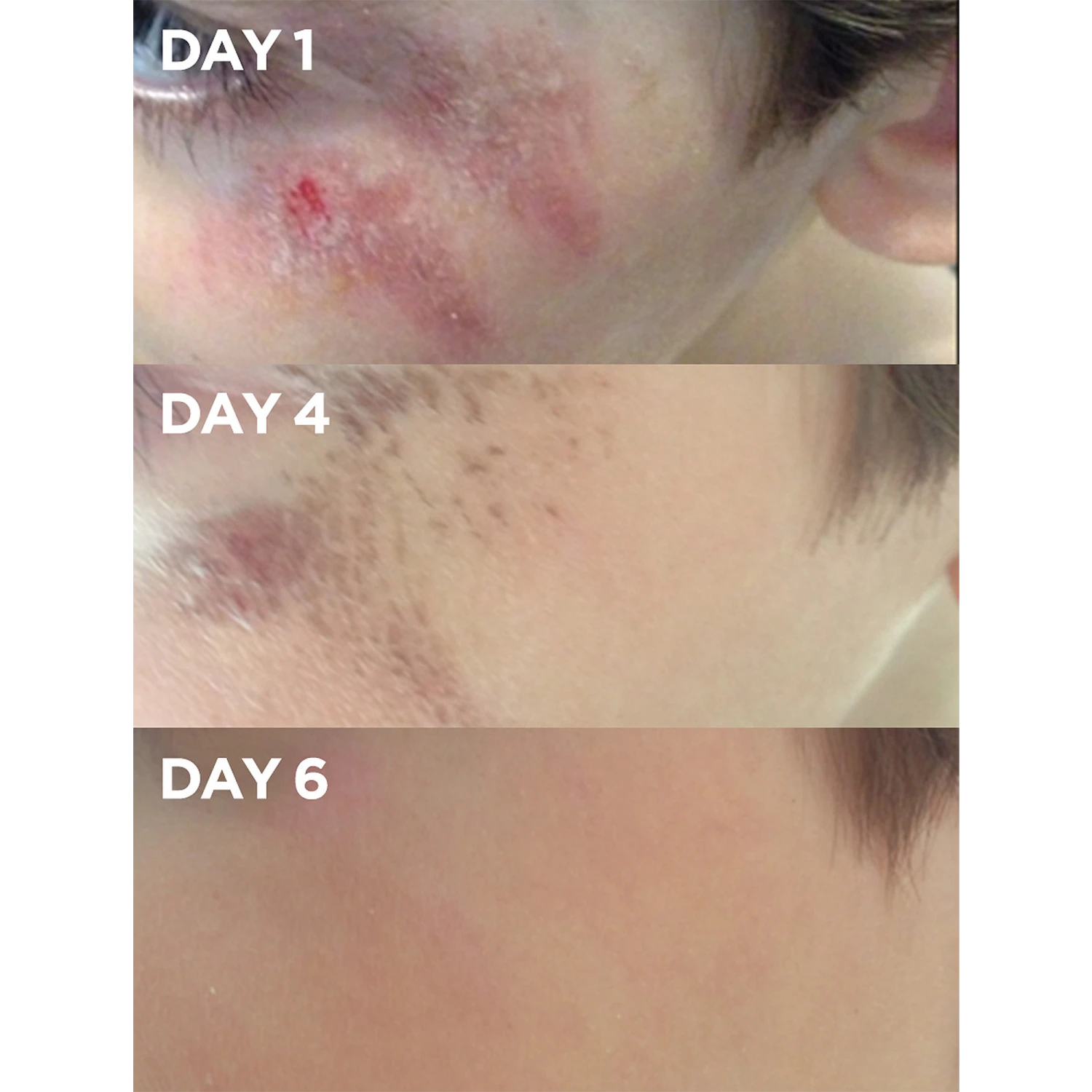 Golden Dry Skin Salve 5 Golden Dry Skin Salve - Image 5