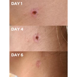 Golden Dry Skin Salve 8 Golden Dry Skin Salve -Cheap Beaunisa Store 2567518cm alt04