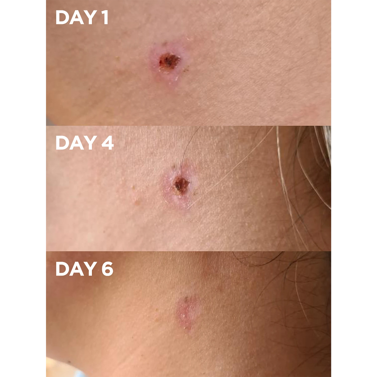 Golden Dry Skin Salve 4 Golden Dry Skin Salve - Image 4