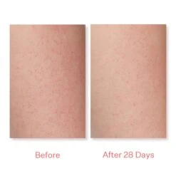 KP Bump Boss Microderm Body Scrub 19 KP Bump Boss Microderm Body Scrub -Cheap Beaunisa Store 2583373cm alt04