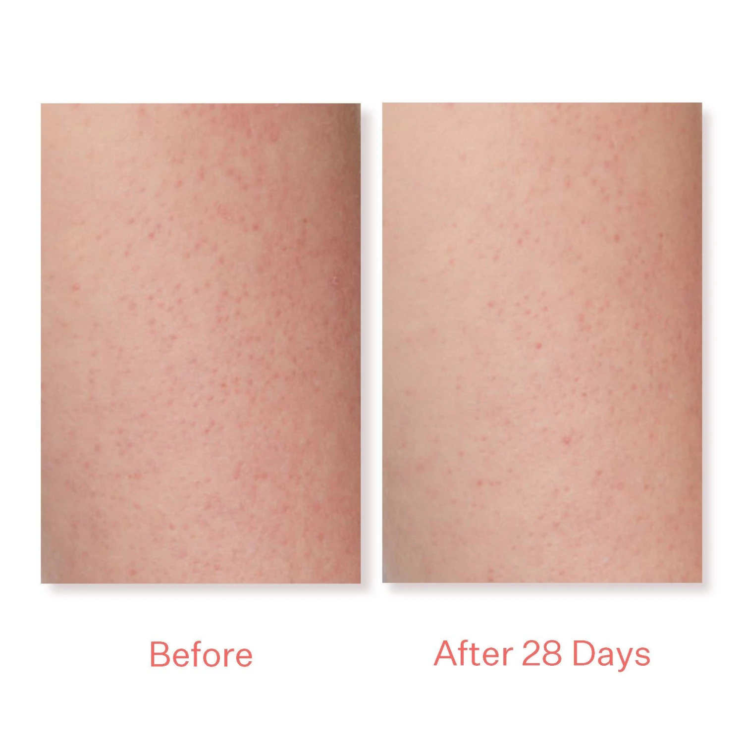 KP Bump Boss Microderm Body Scrub 6 KP Bump Boss Microderm Body Scrub - Image 6