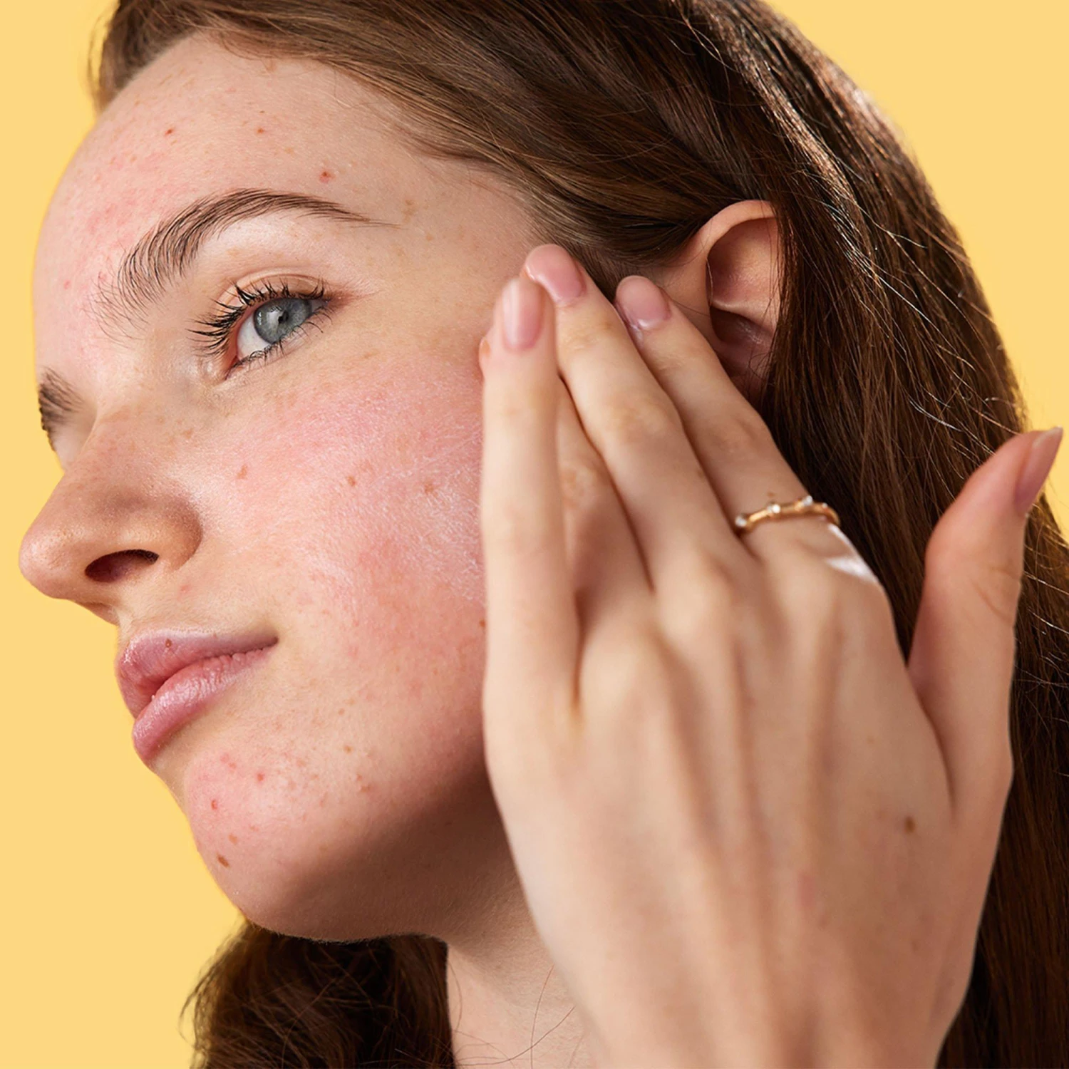 MEGASHADE Breakout-proof SPF 50 Serum 4 MEGASHADE Breakout-proof SPF 50 Serum - Image 4