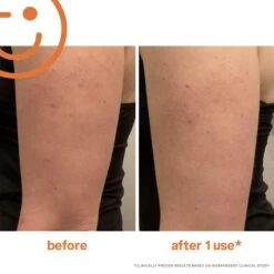 ExfoliKate Resurfacing Body Scrub 16 ExfoliKate Resurfacing Body Scrub -Cheap Beaunisa Store 2595108cm alt02