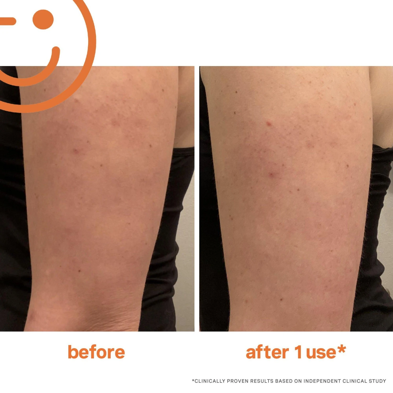 ExfoliKate Resurfacing Body Scrub 8 ExfoliKate Resurfacing Body Scrub - Image 8