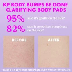 KP Body Bumps Be Gone Clarifying Body Pads 8 KP Body Bumps Be Gone Clarifying Body Pads -Cheap Beaunisa Store 2600594 alt03