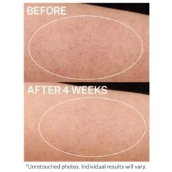 KP Care Bump Exfoliating Body Scrub -Cheap Beaunisa Store 2606171 alt02