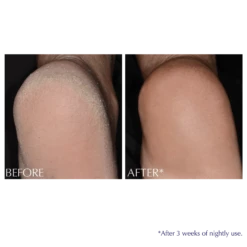 Exfoliating & Conditioning Foot Balm -Cheap Beaunisa Store 2612400 alt04