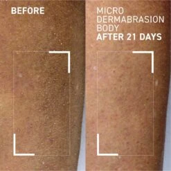 Microdermbrasion Body Polishing Exfoliator -Cheap Beaunisa Store 2613251 alt02